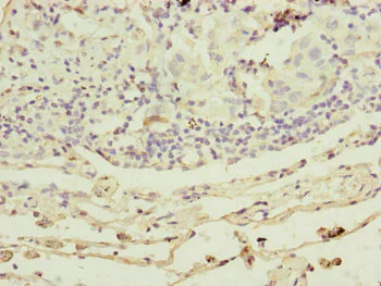 Immunohistochemistry (Formalin/PFA-fixed paraffin-embedded sections) - Anti-RARS2 antibody (AB230274)