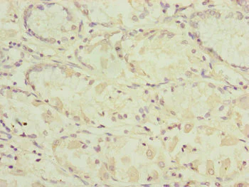 Immunohistochemistry (Formalin/PFA-fixed paraffin-embedded sections) - Anti-RARS2 antibody (AB230274)