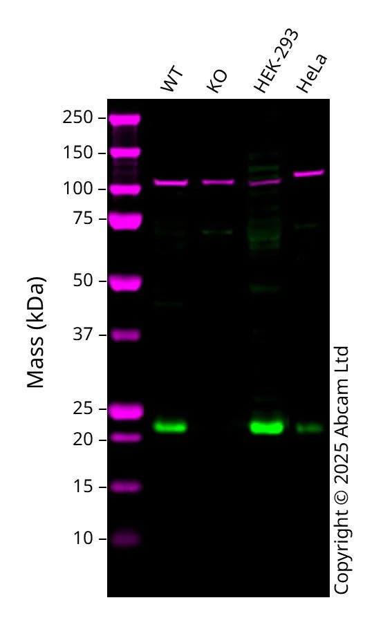 Western blot - Anti-RAS antibody [18/Ras] (AB307738)