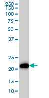 Western blot - Anti-Ras antibody [4F3] (AB55391), expandable thumbnail