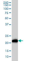 Western blot - Anti-Ras antibody [4F3] (AB55391)