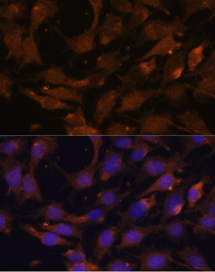 Immunocytochemistry/ Immunofluorescence - Anti-Ras antibody (AB180772)