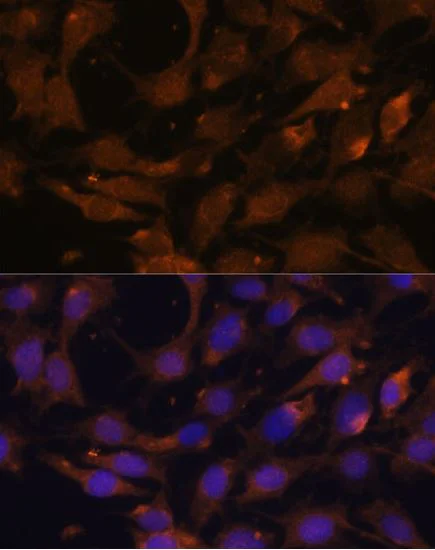 Immunocytochemistry/ Immunofluorescence - Anti-Ras antibody (AB180772)