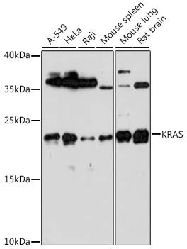 Western blot - Anti-Ras antibody (AB180772)