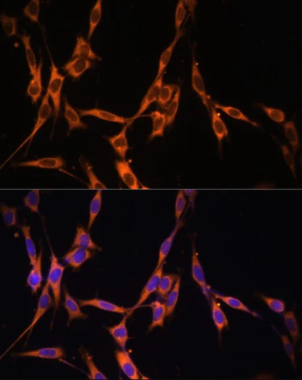 Immunocytochemistry/ Immunofluorescence - Anti-Ras antibody (AB196630)