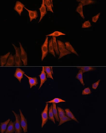 Immunocytochemistry/ Immunofluorescence - Anti-Ras antibody (AB196630)