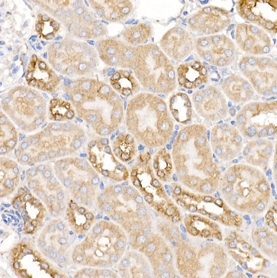 Immunohistochemistry (Formalin/PFA-fixed paraffin-embedded sections) - Anti-Ras antibody (AB196630)