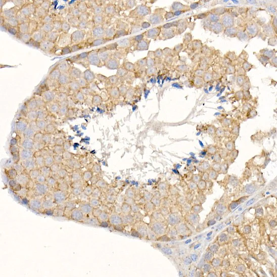 Immunohistochemistry (Formalin/PFA-fixed paraffin-embedded sections) - Anti-Ras antibody (AB196630)