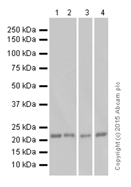 Western blot - Anti-Ras antibody [EP1125Y] (AB52939)