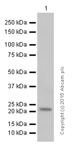 Western blot - Anti-Ras antibody [EP1125Y] (AB52939)