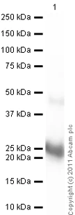 Western blot - Anti-Ras antibody [EP1125Y] (AB52939)