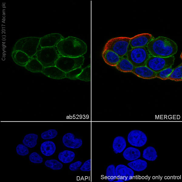 Immunocytochemistry/ Immunofluorescence - Anti-Ras antibody [EP1125Y] - BSA and Azide free (AB271848)