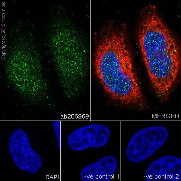 Immunocytochemistry/ Immunofluorescence - Anti-Ras antibody [EPR18713-13] (AB206969)