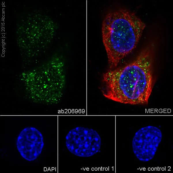 Immunocytochemistry/ Immunofluorescence - Anti-Ras antibody [EPR18713-13] (AB206969)