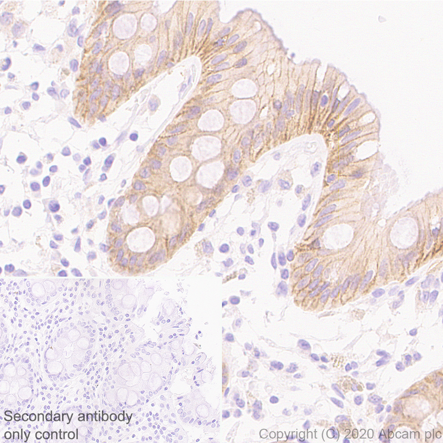 Immunohistochemistry (Formalin/PFA-fixed paraffin-embedded sections) - Anti-Ras antibody [EPR23474-20] (AB275875), expandable thumbnail
