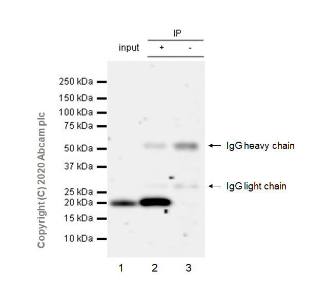 Immunoprecipitation - Anti-Ras antibody [EPR23474-20] (AB275875), expandable thumbnail