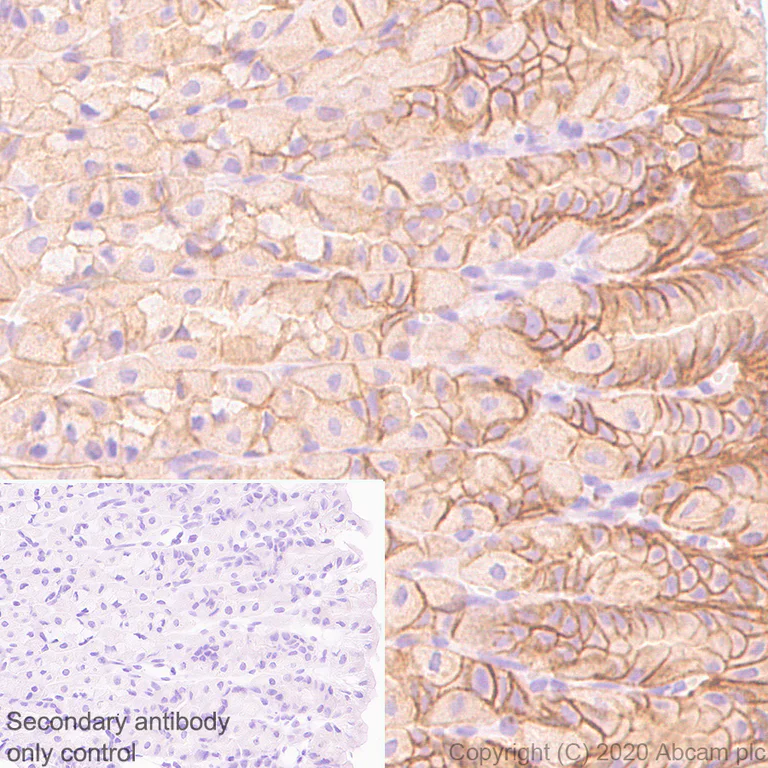 Immunohistochemistry (Formalin/PFA-fixed paraffin-embedded sections) - Anti-Ras antibody [EPR23474-20] - BSA and Azide free (AB275884)