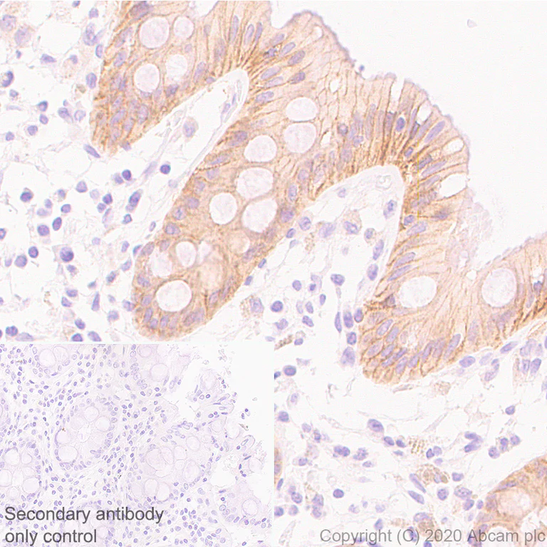 Immunohistochemistry (Formalin/PFA-fixed paraffin-embedded sections) - Anti-Ras antibody [EPR23474-20] - BSA and Azide free (AB275884)