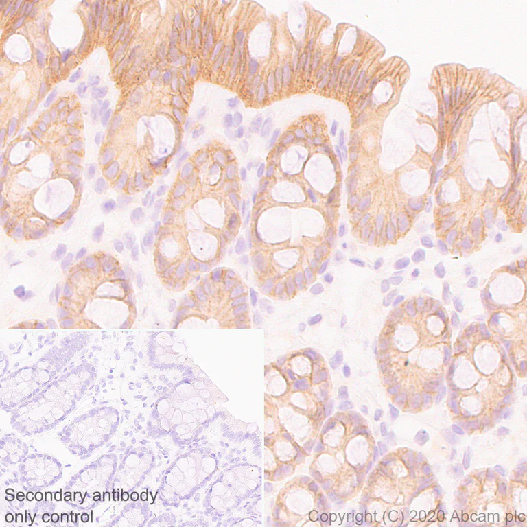 Immunohistochemistry (Formalin/PFA-fixed paraffin-embedded sections) - Anti-Ras antibody [EPR23474-20] - BSA and Azide free (AB275884)