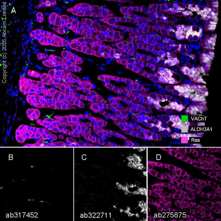 Multiplex immunohistochemistry - Anti-Ras antibody [EPR23474-20] - BSA and Azide free (AB275884)