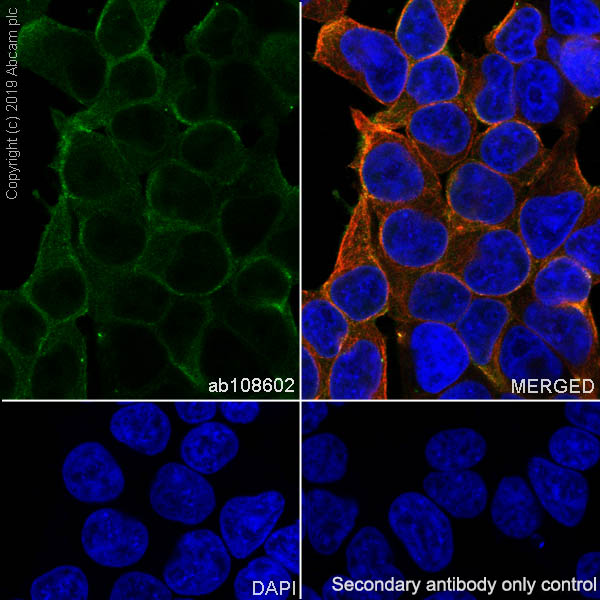 Immunocytochemistry/ Immunofluorescence - Anti-Ras antibody [EPR3255] (AB108602), expandable thumbnail