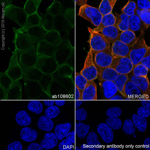 Anti-Ras antibody [EPR3255] (ab108602) | Abcam