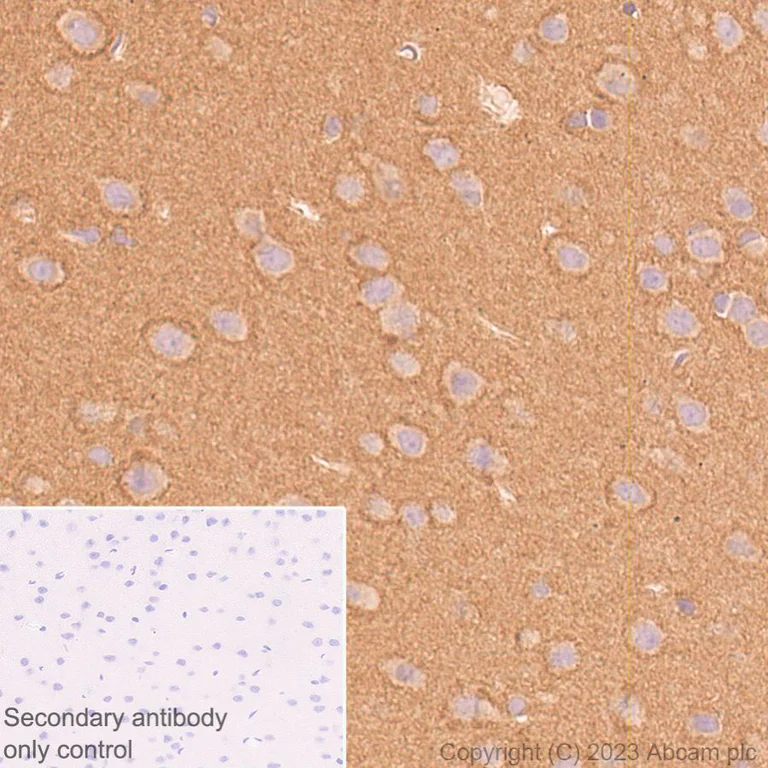 Immunohistochemistry (Formalin/PFA-fixed paraffin-embedded sections) - Anti-Ras antibody [EPR3255] (AB108602)