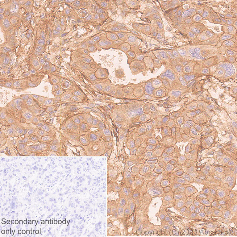 Immunohistochemistry (Formalin/PFA-fixed paraffin-embedded sections) - Anti-Ras antibody [EPR3255] (AB108602)