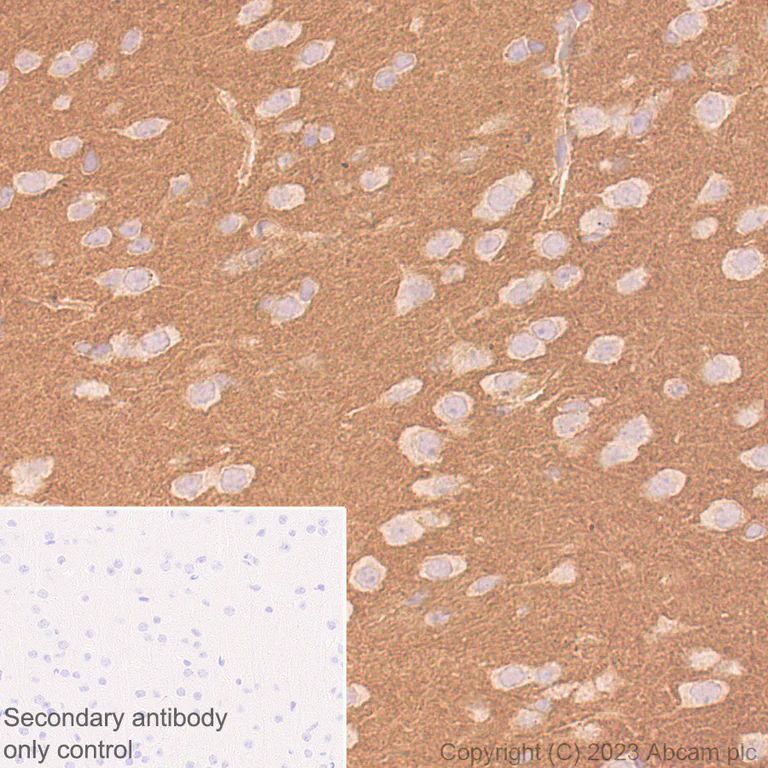 Immunohistochemistry (Formalin/PFA-fixed paraffin-embedded sections) - Anti-Ras antibody [EPR3255] - BSA and Azide free (AB209974)