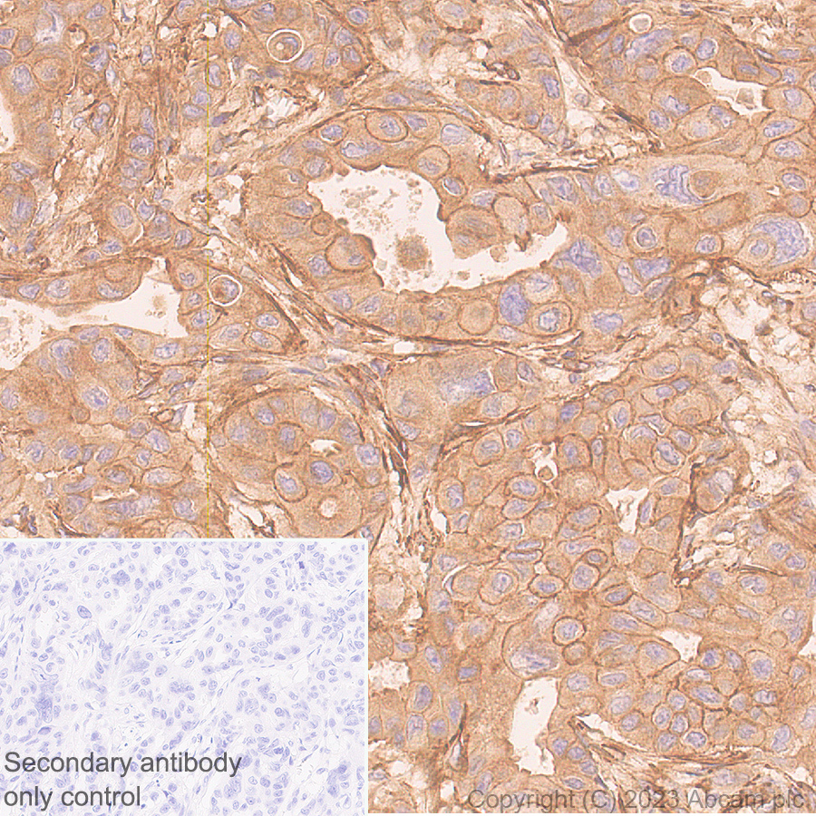 Immunohistochemistry (Formalin/PFA-fixed paraffin-embedded sections) - Anti-Ras antibody [EPR3255] - BSA and Azide free (AB209974)