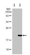 Western blot - Anti-Ras (mutated G12D) antibody (AB221163)