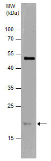 Western blot - Anti-Ras (mutated G12D) antibody (AB221163)