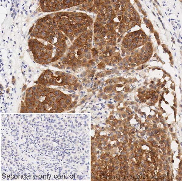 Immunohistochemistry (Formalin/PFA-fixed paraffin-embedded sections) - Anti-Ras (mutated Q61R) antibody [SP174] (ab227658), expandable thumbnail