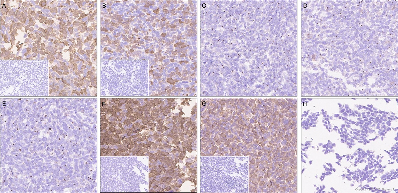 Immunohistochemistry (Formalin/PFA-fixed paraffin-embedded sections) - Anti-Ras (mutated Q61R) antibody [SP174] (ab227658), expandable thumbnail