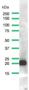 Western blot - Anti-Ras (mutated Q61R) antibody [SP174] (AB227658)