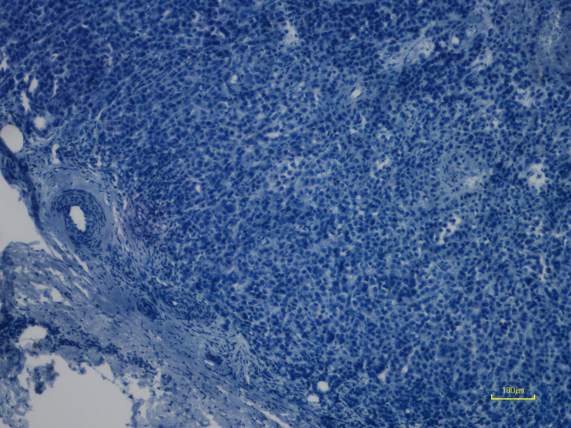 Immunohistochemistry (Formalin/PFA-fixed paraffin-embedded sections) - Anti-Ras (mutated Q61R) antibody [SP174] - BSA and Azide free (AB243933), expandable thumbnail