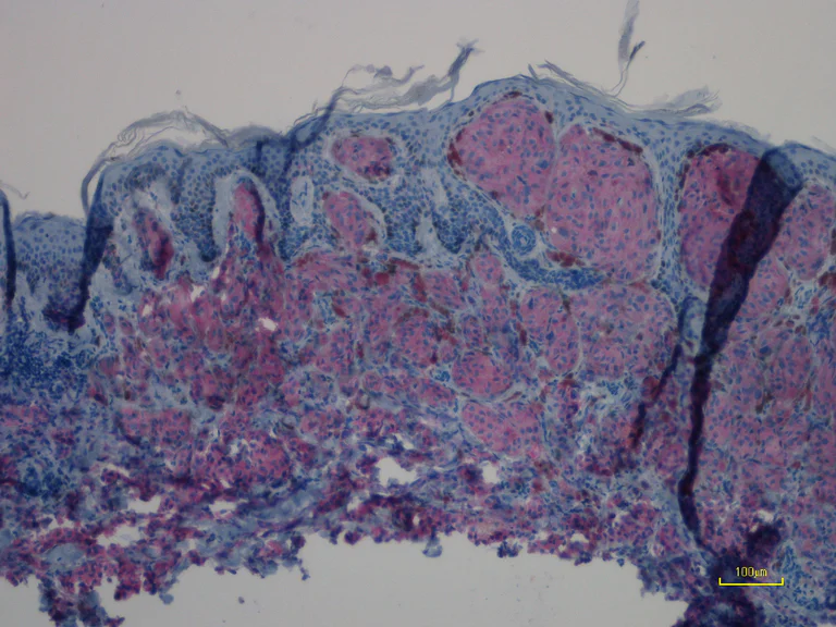 Immunohistochemistry (Formalin/PFA-fixed paraffin-embedded sections) - Anti-Ras (mutated Q61R) antibody [SP174] - BSA and Azide free (AB243933)