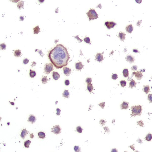 Immunohistochemistry - Anti-Ras (mutated Q61R) antibody [SP174] - BSA and Azide free (ab243933), expandable thumbnail