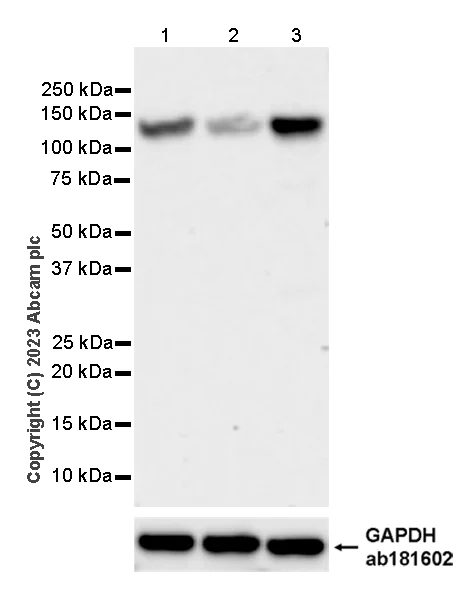 Western blot - Anti-RASA1 antibody [13/RAS-GAP] (AB308530)