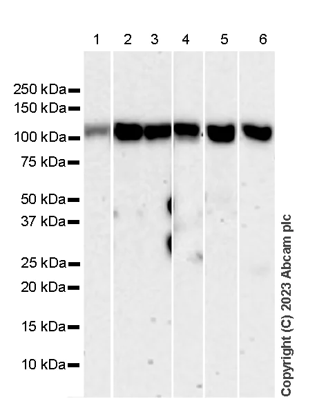 Western blot - Anti-RASA1 antibody [13/RAS-GAP] (AB308530)