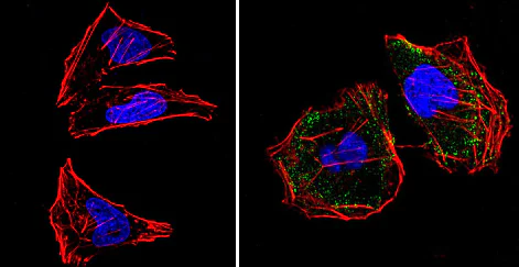 Immunocytochemistry/ Immunofluorescence - Anti-RASA1 antibody [B4F8] (AB2922)