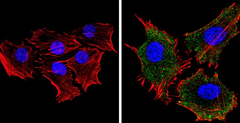 Immunocytochemistry/ Immunofluorescence - Anti-RASA1 antibody [B4F8] (AB2922)