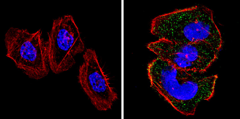 Immunocytochemistry/ Immunofluorescence - Anti-RASA1 antibody [B4F8] (AB2922)