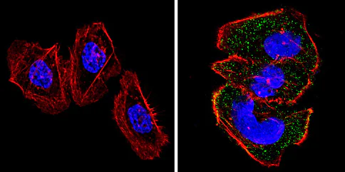 Immunocytochemistry/ Immunofluorescence - Anti-RASA1 antibody [B4F8] (AB2922)