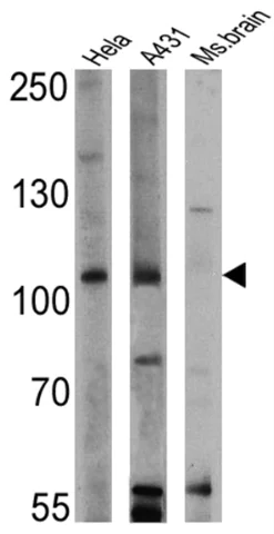 Western blot - Anti-RASA1 antibody [B4F8] (AB2922)