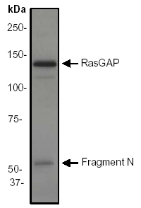Western blot - Anti-RASA1 antibody [EP536Y] (AB40677)