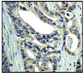 Immunohistochemistry (Formalin/PFA-fixed paraffin-embedded sections) - Anti-RASA1 antibody [EP536Y] - BSA and Azide free (AB247281)
