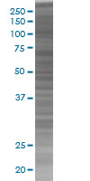 RASA1 overexpression 293T lysate (whole cell)