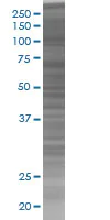 SDS-PAGE - RASA1 overexpression 293T lysate (whole cell) (AB94075)