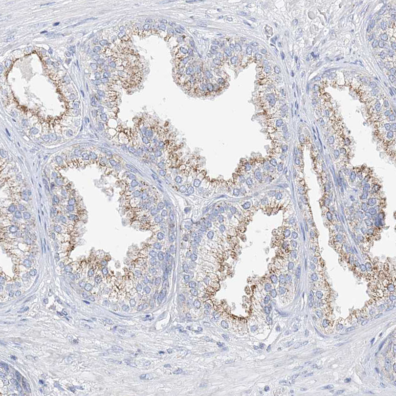 Immunohistochemistry (Formalin/PFA-fixed paraffin-embedded sections) - Anti-RASA2 antibody (AB254590)